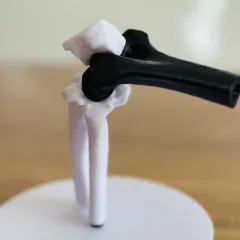 Olecanon Fraktur 3D Modell